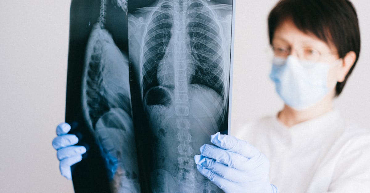 COVID後のリハビリテーションプログラムにおいて、写真撮影などの芸術活動を奨励する。